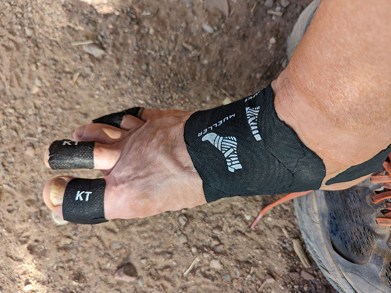 KT-taped toes
